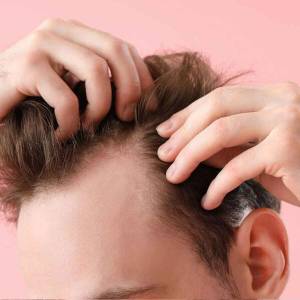 Stem Cell Therapy for Hair Growth and Stop Hair Fall in Sarojini Nagar