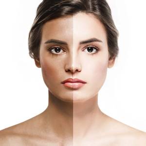 Tan Removal in Lajpat Nagar