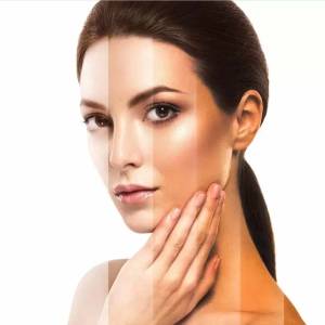 Tan Removal in Lajpat Nagar