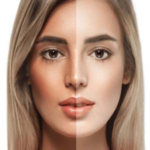 Tan Removal in Faridabad