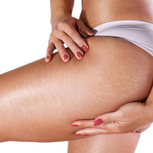Thigh Lift in Ghaziabad