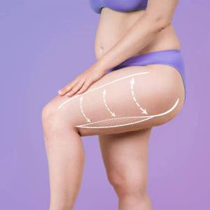 Thigh Tuck in Vasant Vihar