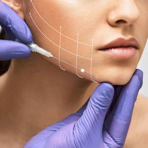 Threads For Skin Tightning in Vivek Vihar