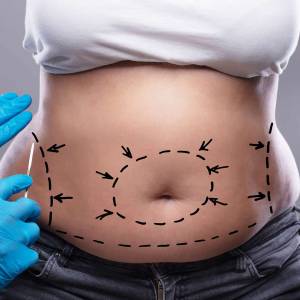 Tucks Therapy in Delhi