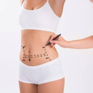 Tucks Therapy in Delhi