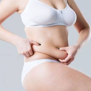 Tummy Tuck in Moti Nagar