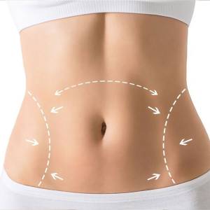 Tummy Tuck in Vivek Vihar