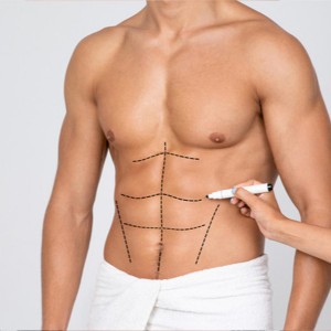 Tummy Tuck in Greater Kailash