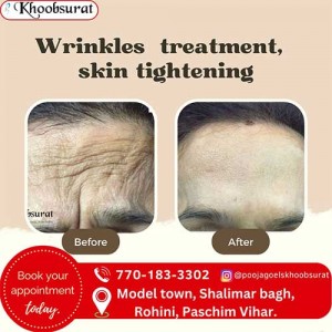 Wrinkles Treatment,  Skin Tightening in Delhi